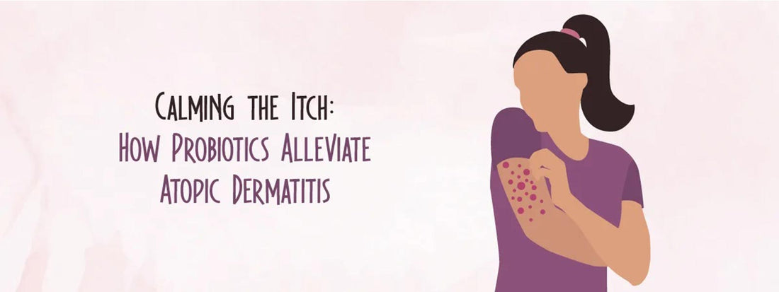 Calming the Itch: How Probiotics Alleviate Atopic Dermatitis